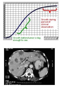 double Liver metastases seen on CT scan. Built-in ruler makes measurement of metastatic lesions easy for subsequent growth calculations.